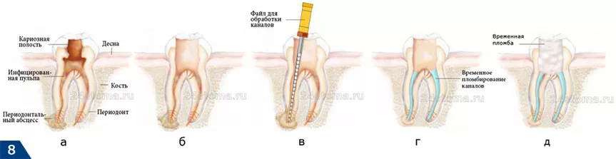 этапы лечения в стоматологической клинике ЭСТ