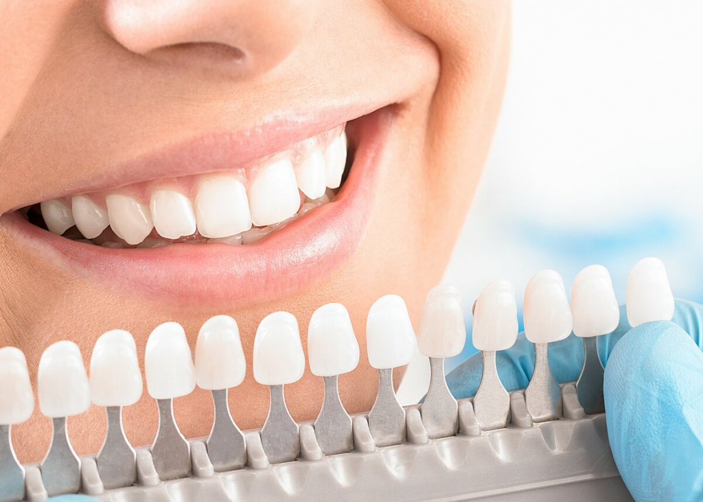 как сделать зубы белыми